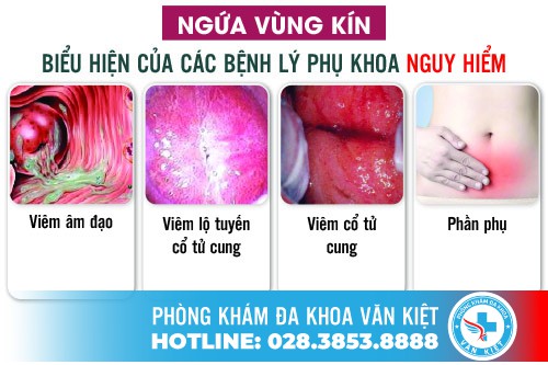 Có nhiều nguyên nhân gây ra tình trạng ngứa vùng kín ở nữ giới Có nhiều nguyên nhân gây ra tình trạng ngứa vùng kín ở nữ giới