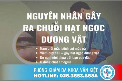 Chuỗi hạt ngọc dương vật có phải là bệnh? Chuỗi hạt ngọc dương vật có phải là bệnh?